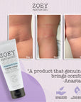 Zoey Naturals Diaper Rash Cream Before and After Use